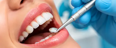 Qué debes saber sobre la limpieza dental